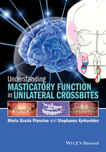 عکس Understanding Masticatory Function in Unilateral Crossbites