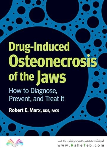 Drug-Induced Osteonecrosis of the Jaws