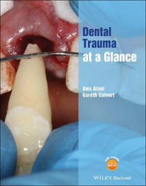 عکس Dental Trauma at a Glance 2021