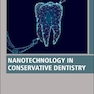 Nanotechnology in Conservative Dentistry