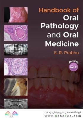 Handbook of Oral Pathology and Oral Medicine