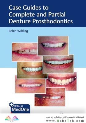 Case Guides to Complete and Partial Denture Prosthodontics 2020