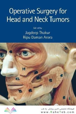 Operative Surgery for Head and Neck Tumors