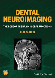 عکس Dental Neuroimaging