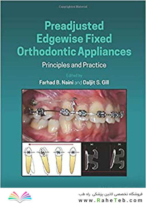 Preadjusted Edgewise Fixed Orthodontic Appliances: Principles and Practice 1st Edicion