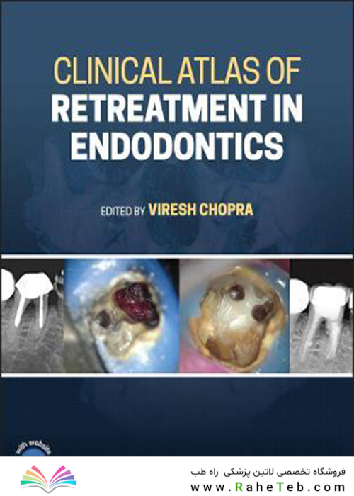 Clinical Atlas of Retreatment in Endodontics