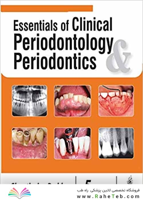 Essentials of Clinical Periodontology and Periodontics 5th Edición