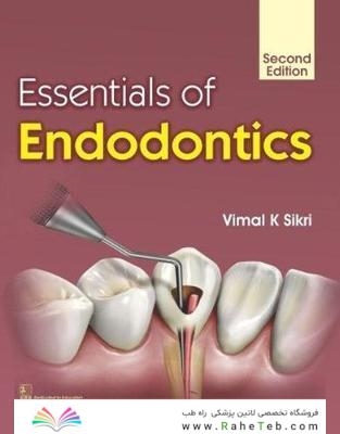 Essentials of Endodontics