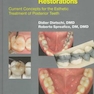 Adhesive Metal-Free Restorations : Current Concepts in the Aesthetic Treatment of Posterior Teeth