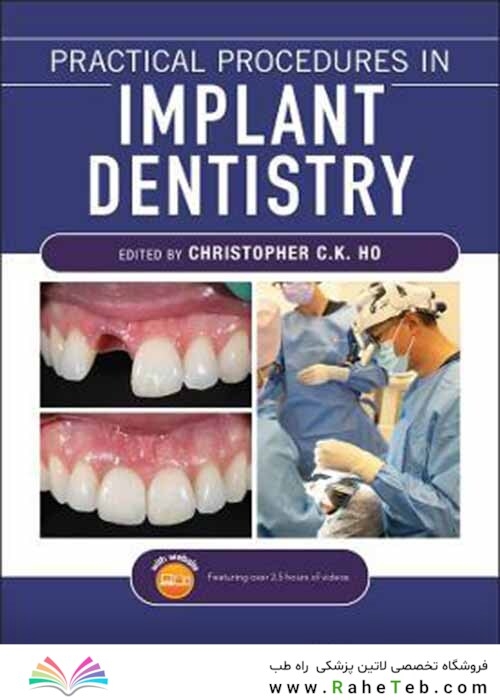 Practical Procedures in Implant Dentistry