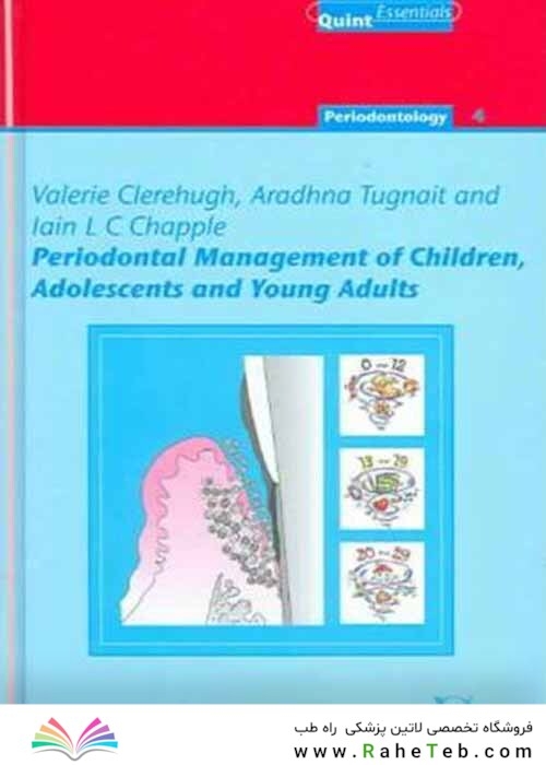 Periodontal Management of Children, Adolescents and Young Adults