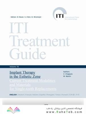 ITI Treatment Guide, Volume 10: Implant Therapy in the Esthetic Zone : Current Treatment Modalities and Materials for Single-tooth Replacements