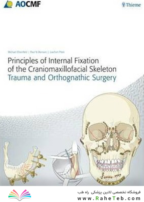 Principles of Internal Fixation of the Craniomaxillofacial Skeleton : Trauma and Orthognathic Surgery 2012