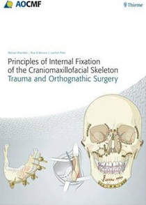 عکس Principles of Internal Fixation of the Craniomaxillofacial Skeleton : Trauma and Orthognathic Surgery 2012