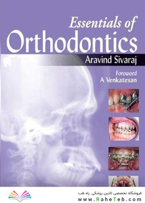 Essentials of Orthodontics 2013
