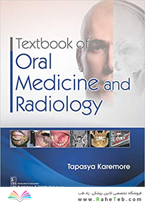 Textbook of Oral Medicine and Radiology