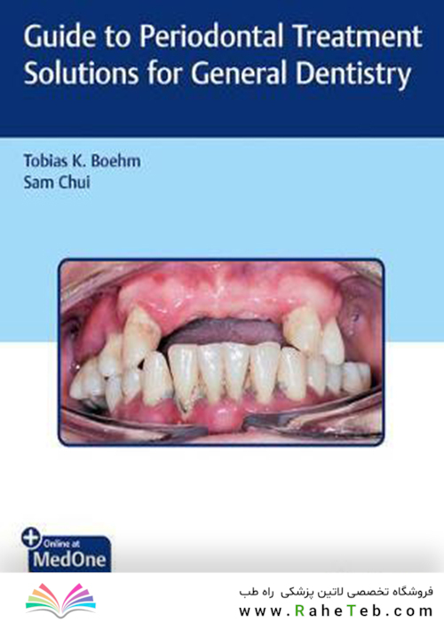 Guide to Periodontal Treatment Solutions for General Dentistry