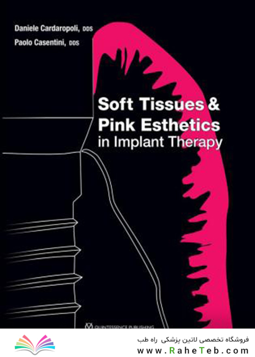 Soft Tissues - Pink Esthetics in Implant Therapy