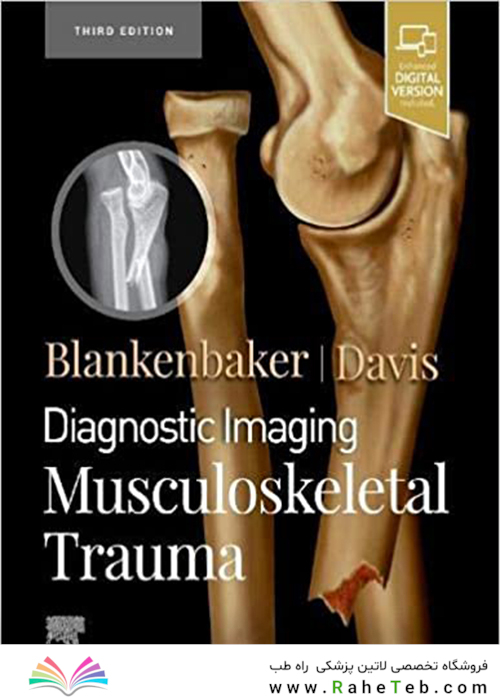 Diagnostic Imaging: Musculoskeletal Trauma 3rd Edición