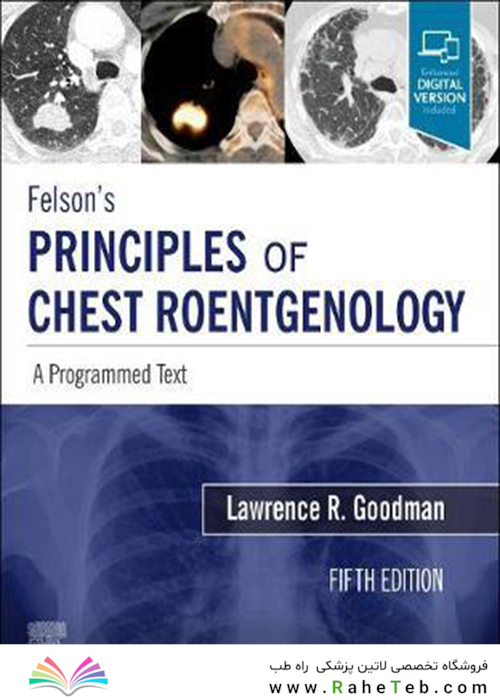 Felson’s PRINCIPLES OF CHEST ROENTGENOLOGY