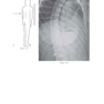 Felson’s PRINCIPLES OF CHEST ROENTGENOLOGY
