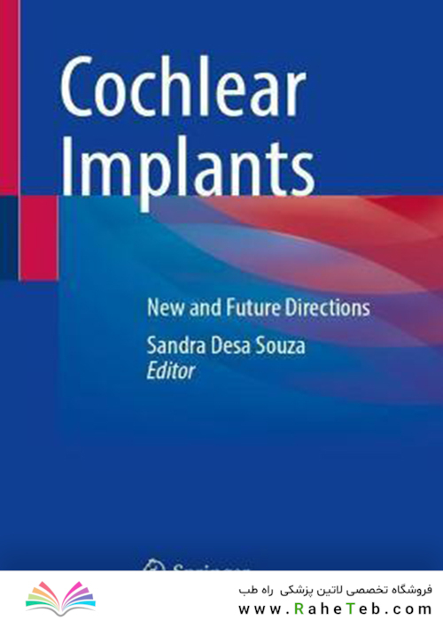 Cochlear Implants: New and Future Directions 1st ed. 2022 Edición
