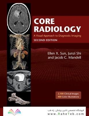 Core Radiology: A Visual Approach to Diagnostic Imaging 2nd Edicion