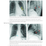Core Radiology: A Visual Approach to Diagnostic Imaging 2nd Edición