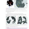 Core Radiology: A Visual Approach to Diagnostic Imaging 2nd Edición