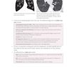 Core Radiology: A Visual Approach to Diagnostic Imaging 2nd Edicion