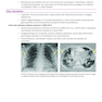 Core Radiology: A Visual Approach to Diagnostic Imaging 2nd Edición