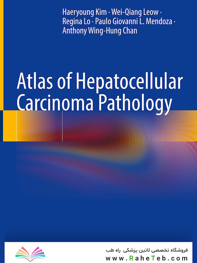 Atlas of Hepatocellular Carcinoma Pathology 1st ed. 2022 Edición