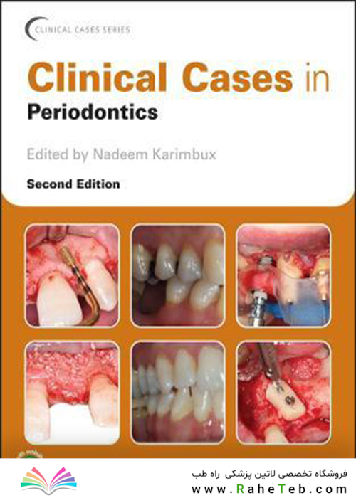 Clinical Cases in Periodontics 1st Edición, Edición Kindle