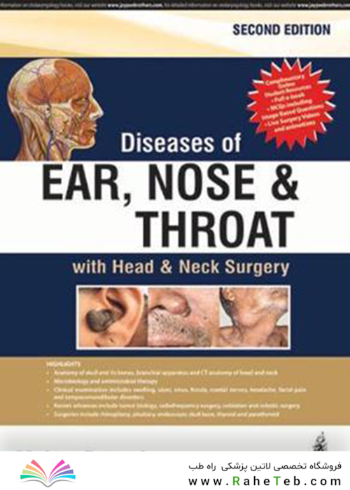 Diseases of Ear, Nose and Throat: with Head - Neck Surgery