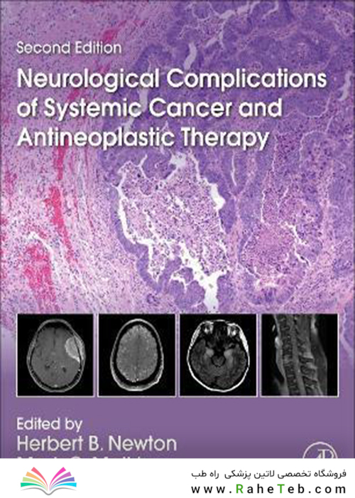 Neurological Complications of Systemic Cancer and Antineoplastic Therapy 2nd Edición