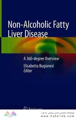 Non-Alcoholic Fatty Liver Disease: A 360-degree Overview 1st ed