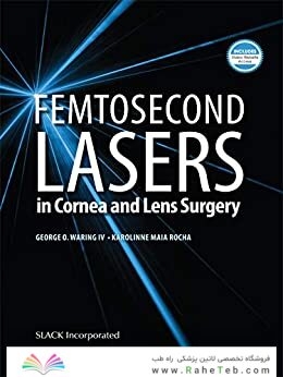 Femtosecond Lasers in Cornea and Lens Surgery 1st Edición