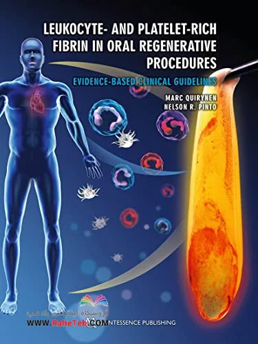 Leukocyte- and Platelet-Rich Fibrin in Oral Regenerative Procedures: Evidence-Based Clinical Guidelines 2022