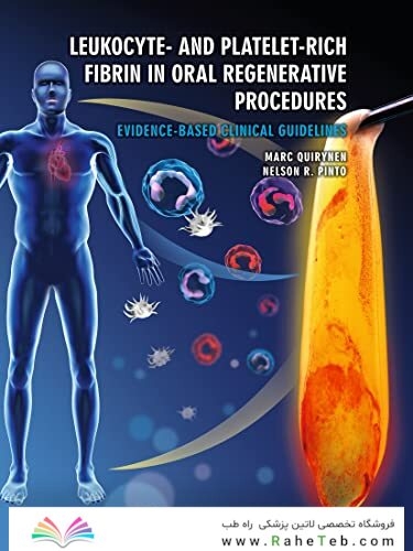 Leukocyte- and Platelet-Rich Fibrin in Oral Regenerative Procedures: Evidence-Based Clinical Guidelines 2022
