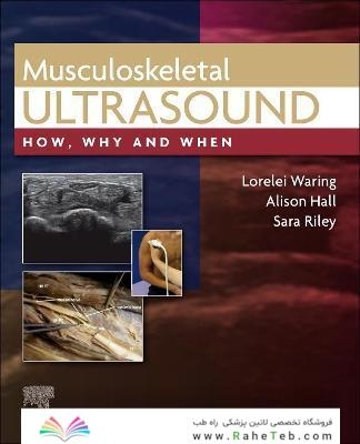 Musculoskeletal Ultrasound: How, Why and When 1st Edición