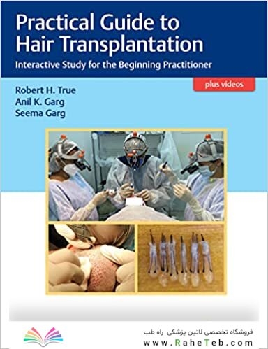Practical Guide to Hair Transplantation