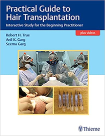 عکس Practical Guide to Hair Transplantation