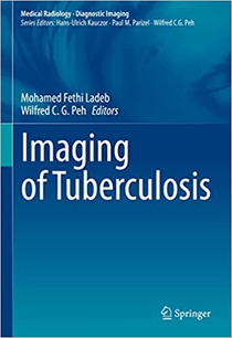 عکس Imaging of Tuberculosis