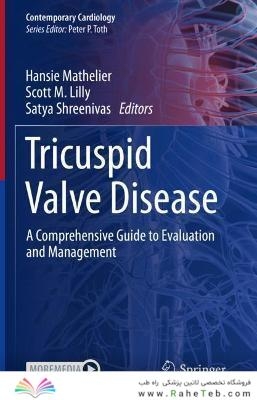 Tricuspid Valve Disease: A Comprehensive Guide to Evaluation and Management (Contemporary Cardiology) 1st ed. 2022 Edition
