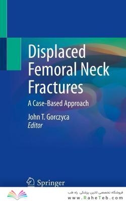 Displaced Femoral Neck Fractures : A Case-Based Approach