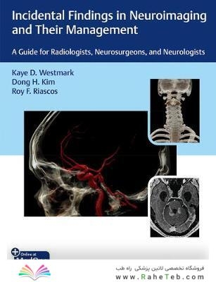 Incidental Findings in Neuroimaging and Their Management: A Guide for Radiologists, Neurosurgeons, and Neurologists