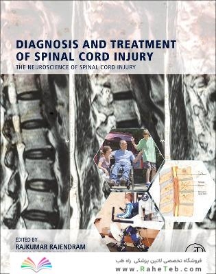 Diagnosis and Treatment of Spinal Cord Injury