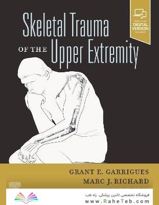 Skeletal Trauma of the Upper Extremity