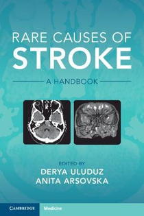 عکس Rare Causes of Stroke: A Handbook