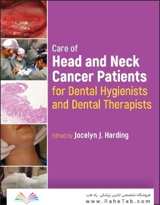 Care of Head and Neck Cancer Patients for Dental Hygienists and Dental Therapists